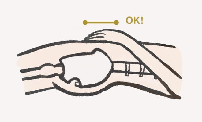 上前腸骨棘を手で触り、骨盤が正常でニュートラルな位置にある場合のイメージ